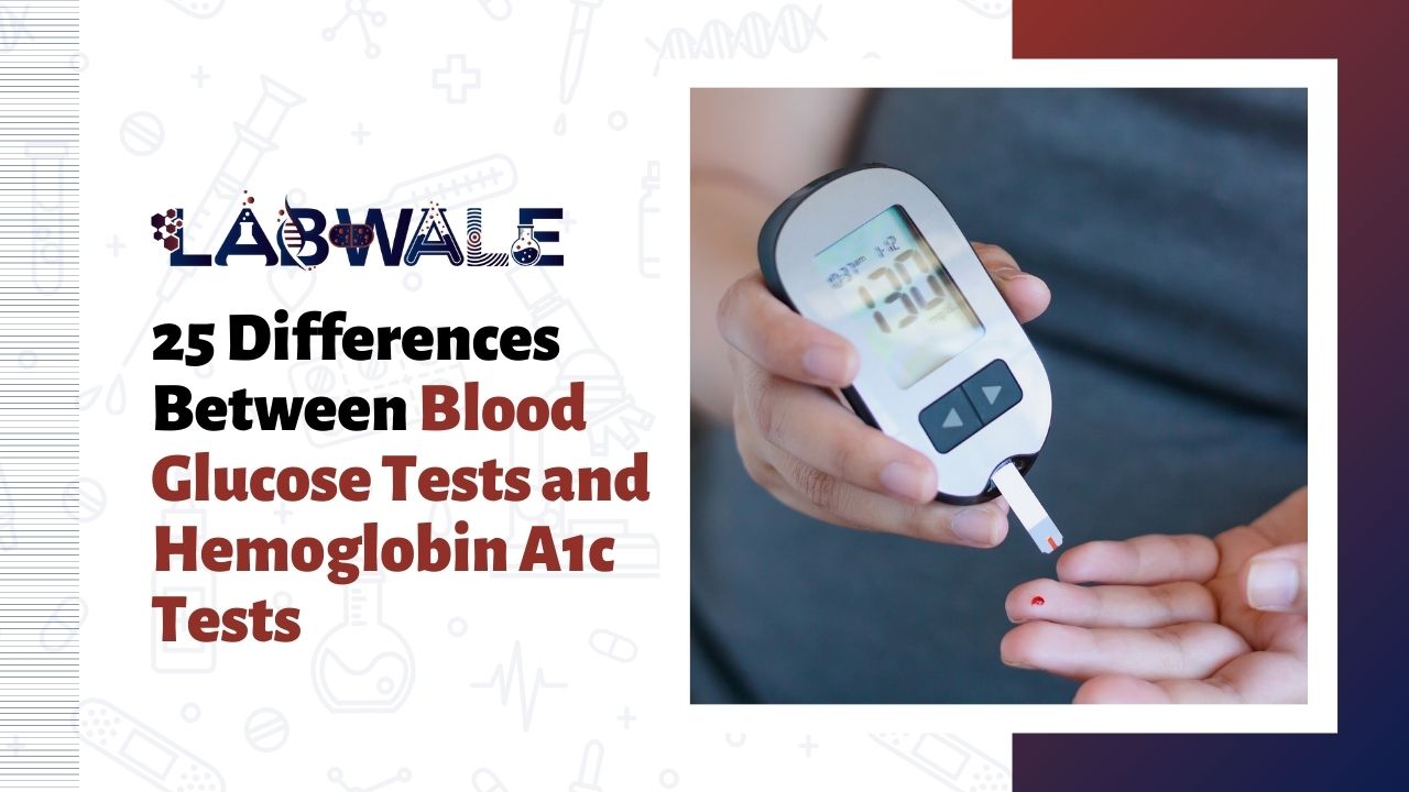 25 Differences Between Blood Glucose Tests and Hemoglobin A1c Tests