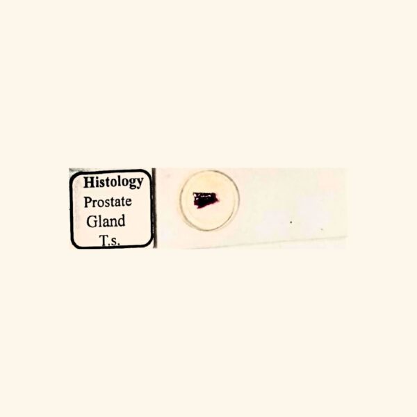 Prostate Gland - Transverse Section / Cross Section - Histology Prepared Slide for Microscopy