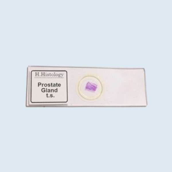 Histology - Prostate Gland - Transverse Section - Permanent Slide