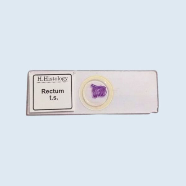 Histology - Rectum - Transverse Section - Permanent Slide