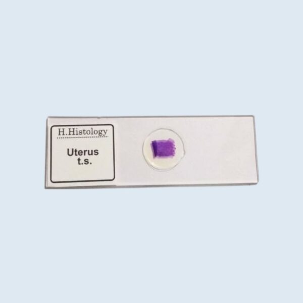 Histology - Uterus - Transverse Section - Permanent Slide