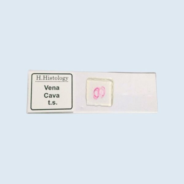 Histology - Vena Canva - Transverse Section - Permanent Slide