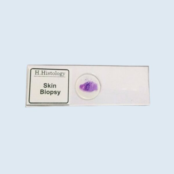 Histology - Skin Biopsy - Permanent Slide