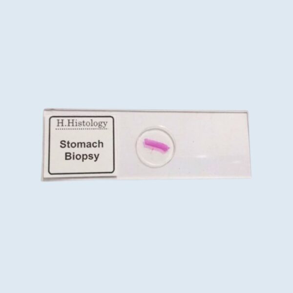 Histology - Stomach Biopsy - Permanent Slide