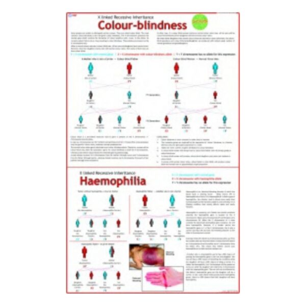 Colour-blindness - Science Educational Chart – Laminated Paper