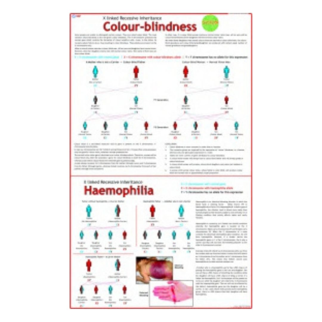 Colour-blindness Educational Chart – Laminated Paper (70 x 100 cm)