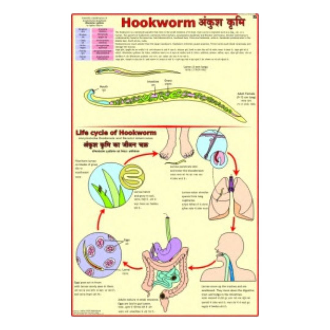 Hookworm Educational Chart – Laminated Paper (70 x 100 cm)