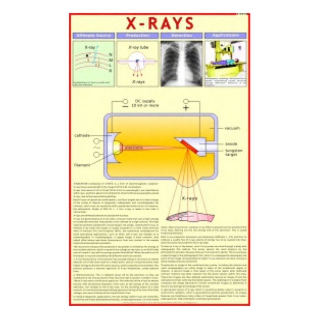 X-Rays Educational Chart – Laminated Paper (70 x 100 cm)