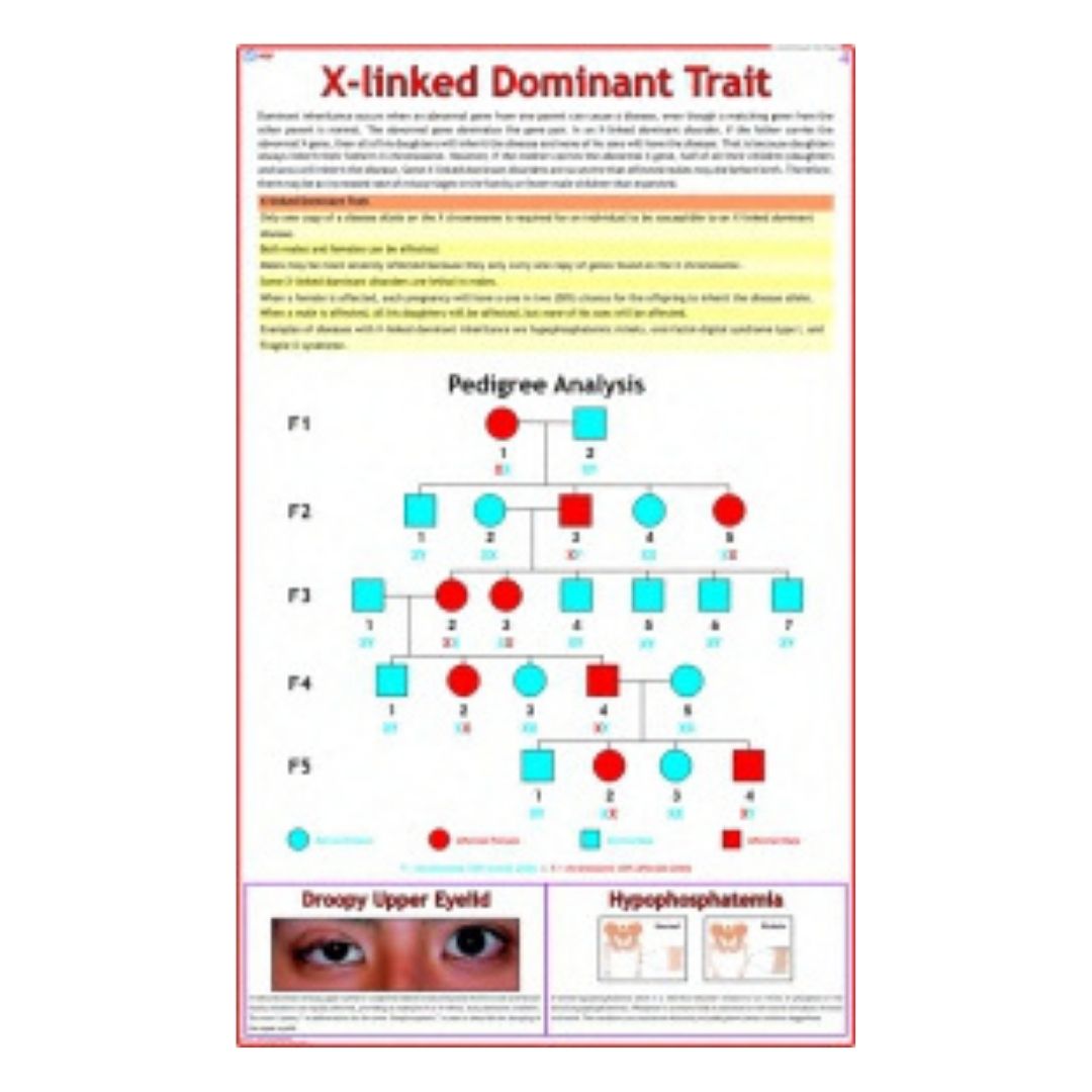 X-linked Dominant Trait Educational Chart – Laminated Paper (70 x 100 cm)